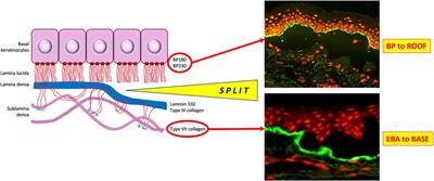 Diagnostic Techniques in Autoimmune Blistering Diseases